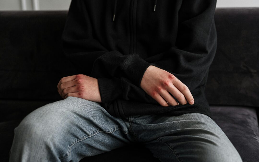 Self-harm: 7 Powerful Ways to Understand and Prevent It